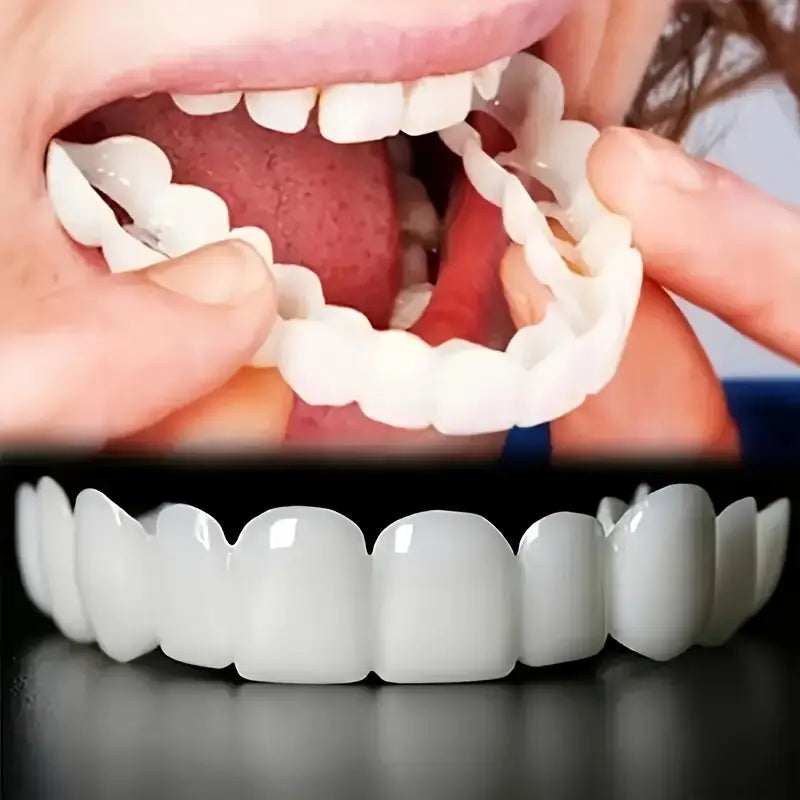 Pair of Snap-On Teeth Covers – Natural Look, Instant Smile Upgrade